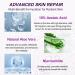 Marianp Hyaluronic Acid Serum & Azelaic Acid 10% for Acne Pigmentation & Rosacea - Vitamin B3 & B5 | Best Skincare Treatment - Buy Online on SooperMarket.com