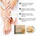 Foot Cream for Cracked Heels and Dry Skin Feet Hard Skin Remover Foot Moisturiser Callus Remover for Feet Nourishes Feet & Hand Foot Care Cream to Improve Elasticity & Smoothen Skin - Buy Online on SooperMarket.com