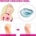 Moisturizing Gel Heel Socks Cracked Gel Heel Socks Toeless Heel Repair Socks for Women (Azure) - Buy Online on SooperMarket.com