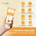 Kojic Acid Soap for Hyperpigmentation - Skin Brightening Papaya Wash - Dark Spot Remover for Acne Scars & Even Skin Tone - Turmeric Cleanser for Glowing Skin - Buy Online on SooperMarket.com