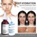 AHA 5% + BH_A 1% Peeling Solution Smooth Skin Exfoliating Facial Serum -Acid Serum For Acne Blackheads & Open Pores Blackhead Remover Reduces Excess Oil & Bumpy Texture 32ml  - Buy Online on SooperMarket.com