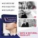 Invisible Waterproof Face Lift Tape - 40 Pcs Instant Lifting Stickers for Face & Neck - High Elasticity, Makeup Tools for Wrinkle Reduction & Facial Line Improvement - Buy Online on SooperMarket.com