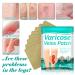 Fengyang 16Pcs Varicose Veins Treatment Patch Set for Legs - Spider Vein Relief, Soothes Leg Fatigue - Buy Online on SooperMarket.com