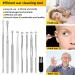 9 Pcs Ear Pick Earwax Removal Kit Ear Cleansing Tool Set Ear wax Removal Tool Ear Curette Ear Wax Remover Tool with a Cleaning Brush and Storage Box Medical Grade for Children and Adults Silver - Buy Online on SooperMarket.com