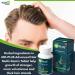 HairMD MD Plus Hair Growth Multivitamin Tablets - Biotin, Keratin, Saw Palmetto - Hair Loss Treatment & DHT Blocker - Buy Online on SooperMarket.com