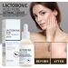 Lactobionic Acid Pore Refining Serum Lactobionic Acid Pore Refining Serum Always Young Lactobionic Acid Serum for Women (2pcs) - Buy Online on SooperMarket.com