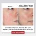 Buy Thayer's Witch Hazel with Aloe Vera - Lavender Toner 12 oz | International Shipping Available - Buy Online on SooperMarket.com