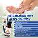 Natrulo All Natural Athlete s Foot Spray - 1oz Liquid Antifungal Itch Relief - Vegan Essential Oil Remedy for Fungus Treatment and Skin Healing - Buy Online on SooperMarket.com