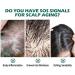 FIOERDTUIE Adults Hair Growth Essential Oil Follicle Repair Moisturizing Nourishing Essence Haircare Serum Beauty Supplies - Buy Online on SooperMarket.com