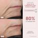 NuFACE Mini & FIX Starter Kits - FDA Cleared Microcurrent Device for Face Sculpting & Line Smoothing - Aqua Gel & FIX Serum Included - Buy Online on SooperMarket.com