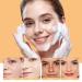 Shop Turmeric Face Wash - Acne Cleanser Kojic Acid Foaming Facial Cleanser for Women | 5.28 FLOZ - Buy Online on SooperMarket.com