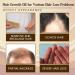 Trendyfave Hair Growth Serum Hair Serum for Hair Growth Ginger Hair Growth Serum Anti Hair Loss Essence for Fast Hair Growth Nourishing Repair Damaged Hair Stimulates Hair Growth Serum for Women Men - Buy Online on SooperMarket.com