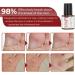 Xebular Foot Corn Removal Gel - Extra Strength Liquid for Toes - Callus & Corn Remover (3 PCS) - Buy Online on SooperMarket.com