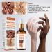 Skin Bleaching Serums | Dark Skin Permanent Whitening Lightening | Armpit Bleaching Serums for Women Supercharged Face Serums Skin Lightening Bleaching Oil Black Spot Corrector Remover for Face 2Pcs - Buy Online on SooperMarket.com