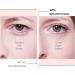 Small Wonderstripes Eye Lid Tape - 64 Pack | Eyelid Lifting Strips for Hooded & Droopy Eyes | Invisible Silicone Tape for All Shapes | Easy Makeup Application - Buy Online on SooperMarket.com