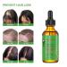 Rosemary Hair Growth Oil & Serum - Dry Scalp Treatment for Women | Hair Thickening & Essential Oil (2OZ) - Boost Hair Growth & Combat Hair Loss - Buy Online on SooperMarket.com