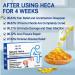 Heca Natural Herbal Hemorrhoid Capsules - 5pcs | Hemorrhoid Relief Treatment Suppositories for Hemeroide Relief, Helps Relieve Discomfort - Buy Online on SooperMarket.com