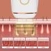 Pohtyit IPL Hair Removal Device - Portable Intense Pulse Light for Back Face Legs Armpits & Bikini Zone - Fast & Effective Hair Removal - Buy Online on SooperMarket.com