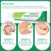 15g Portable Anti-Itch Cream: Soothes & Repairs Sensitive Skin - Buy Online on SooperMarket.com
