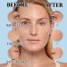 Hyaluronic Acid Serum for Face 95% Hyaluronic Acid & Vitamin C+E - Anti Wrinkle + Anti Aging Hydrochloric Acid Face Serum - Antiaging Hydrating Serums Skincare Dark Spot Remover for Face - Buy Online on SooperMarket.com