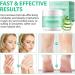 Urea Cream 40 Percent Urea Cream 40 Percent for Feet 150g Urea Cream for Cracked Heels and Dry Skin Deep Moisturizing Nourishing Urea Foot Cream 40 Percent Plus 2% Salicylic Acid - Buy Online on SooperMarket.com