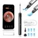 Qimic Ear Wax Removal with Tweezers - 1080P HD Ear Cleaner Ear Camera Otoscope Omni-Direction Ear Pick Tweezer Real-Time Remote Video Multi Earwax Cleaning Replacement Kits Black