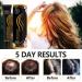Hair Growth Serum for Men & Women | Boost Hair Growth Treat Hair Loss & Achieve Full Hair - 20ml - Buy Online on SooperMarket.com