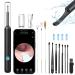 NURSETEK Ear Wax Removal Tool Ear Wax Removal Ear Cleaner with 1080P HD Camera Ear Wax Cleaning Kit Ear Wax Removal Tool for iOS and Android (Black)