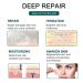 Silicone Scar Sheets Roll (1.6 x 120) for Scar Removal - Professional Grade Strips for Surgery, C-Section, Burn, Acne, Keloid - Safe & Reusable - Buy Online on SooperMarket.com