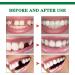 Funnaura Teeth Filling Repair Kit Permanent with Tweezers Temporary Tooth Filler for Missing Broken Fake Chipped Toothy - Buy Online on SooperMarket.com