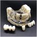 Implant Tooth Template | Oral Simulation Dental Study Model for Teaching - Shop Internationally - Buy Online on SooperMarket.com