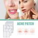Gentle Solution for Stain Removal | 132 Pimple Spot Treatment for Smooth Skin - Buy Online on SooperMarket.com