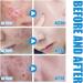 Face Serum Hyaluronic Acid Serum Collagen Boosting Serum Reduce Hyperpigmentation And Anti Aging Serum For Face Skin Repair Acne Dark Spot Remover Fine Line And Wrinkles Face Serums Skincare - Buy Online on SooperMarket.com