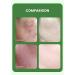 PrimeCove - 5% Azelaic Acid Facial Cream (50g) | Lightweight Hydrating Formula With Niacinamide For Clearer & Brighter Skin - Buy Online on SooperMarket.com