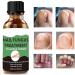 Nail Fungus Treatment For Toenail - Extra Strong Fungal Nail Treatment - Anti fungus Nail Repair and Strengthen Fix & Renew Damaged Broken Nails (2PC) - Buy Online on SooperMarket.com