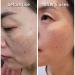 Hydrogen Dual Skin Changer Set | Hydrating Anti-Aging K-Beauty Therapy | International Shipping - Buy Online on SooperMarket.com