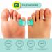 Buy Welnove Gel Toe Spreader - 12-Pack Small Toe Cushions & Sleeves for Friction Relief (Green) | International Shipping Available - Buy Online on SooperMarket.com