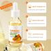 Skincare Set for Teenage Girls - Turmeric Skin Care Sets & kits - Gifts for Her - Pamper Skincare Set - Women Gift Sets with Face Soap-Face Serum-Face Cream-Toner-Mask*4 - Buy Online on SooperMarket.com