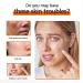 Kojic Acid Soap Olive Oil Soap Kojic Acid Soap Original Olive Oil Soap Bar for Face And Body Acne Dark Spots Hyperpigmentation Smooth Skin Mens Soap Bar for Improve Uneven Skin Tone - Buy Online on SooperMarket.com