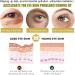 Under Eye Masks - 5pairs 24K Under Eye Patches - Eye Masks Skincare for Puffy Eyes Dark Circles Bags Gold Eye Pads Anti-Aging Hyaluronic Acid Moisturiser Remove Eye Bags Hydrating - Buy Online on SooperMarket.com
