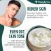 TreeActiv Acne Scar Cream - Effective Treatment for Face & Body Scars Stretch Marks 500+ Uses - All Skin Types - Buy Online on SooperMarket.com