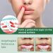 Mundspray - Ultimate Oral Ulcer Relief Bad Breath Reduction Dry Mouth Treatment & Gum Protection | Shop Now! - Buy Online on SooperMarket.com