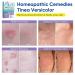 Tinea Versicolor Natural Skin Cream - Effective Treatment for All Skin Types - Buy Online on SooperMarket.com