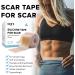 GEN'C B AUTY Silicone Scar Tape Scars Removal Strips Waterproof Scar Bandage(1.6 x 120 Roll) - Buy Online on SooperMarket.com