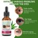 Aloe Vera Anti Aging Eye Serum | Dark Circle & Puffiness Treatment for Women - Buy Online on SooperMarket.com