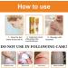 Bee Venom Cream for Psoriasis Cream Bee Venom Cream Psoriasis Treatment New Zealand Bee Venom Chinese Herbal Cream for Psoriasis Bee Venom Psoriasis Soothing Itching 20g (2) - Buy Online on SooperMarket.com