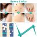 Skin Tag Remover 2 in 1 Kit for Medium/Large Skin Tags - Painless Mole Wart Treatment Tool for Face and Body - Buy Online on SooperMarket.com