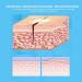 Skin-Friendly Zip Stitch Sutures - Breathable & Adjustable 2 Pack for Emergency Wound Closure - Buy Online on SooperMarket.com