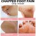 Cracked Heel Repair Cream Stick Foot Moisturizing Stick Foot Cream For Very Dry Feet Foot Cream For Calluses And Hard Skin Foot Moisturiser Callus Remover Soften For Feet Knees Hand - Buy Online on SooperMarket.com
