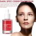 Trendyfave Dark Spot Serum Niacinamide Serum Brightening Serum 10% Niacinamide+ 4% Tranexamic Acid Dark Spot Corrector For Face Age Spot Remover For Face Face Redness Remover Arbutin Serum - Buy Online on SooperMarket.com